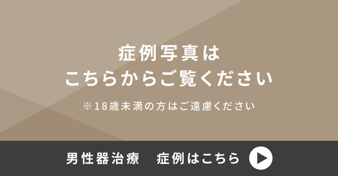 症例写真はこちらからご覧ください ※18歳未満の方はご遠慮ください 男性器治療　症例はこちら